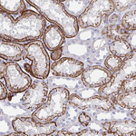 N-cadherin Antibody in Immunohistochemistry (Paraffin) (IHC (P))