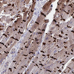 N-cadherin Antibody in Immunohistochemistry (Paraffin) (IHC (P))
