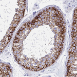 N-cadherin Antibody in Immunohistochemistry (Paraffin) (IHC (P))