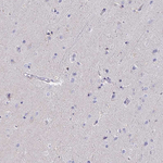 AIF Antibody in Immunohistochemistry (Paraffin) (IHC (P))