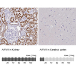 AIF Antibody in Immunohistochemistry (Paraffin) (IHC (P))