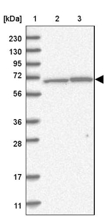 AIF Antibody in Western Blot (WB)