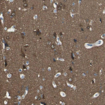 PGP9.5 Antibody in Immunohistochemistry (Paraffin) (IHC (P))