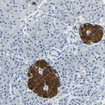 PGP9.5 Antibody in Immunohistochemistry (Paraffin) (IHC (P))