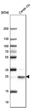 PGP9.5 Antibody in Western Blot (WB)