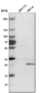 PGP9.5 Antibody in Western Blot (WB)