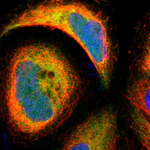 BID Polyclonal Antibody