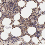 BID Antibody in Immunohistochemistry (Paraffin) (IHC (P))