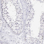 BID Antibody in Immunohistochemistry (Paraffin) (IHC (P))