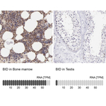 BID Antibody in Immunohistochemistry (Paraffin) (IHC (P))