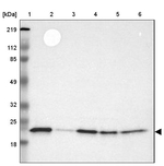 BID Antibody in Western Blot (WB)