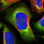 PKC alpha Polyclonal Antibody
