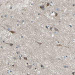 PKC alpha Antibody in Immunohistochemistry (Paraffin) (IHC (P))