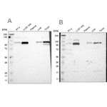 PKC alpha Antibody in Western Blot (WB)