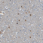 PKA alpha Antibody in Immunohistochemistry (Paraffin) (IHC (P))