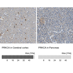 PKA alpha Antibody in Immunohistochemistry (Paraffin) (IHC (P))
