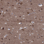Stathmin 1 Antibody in Immunohistochemistry (Paraffin) (IHC (P))