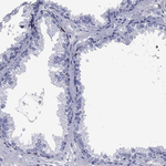 Stathmin 1 Antibody in Immunohistochemistry (Paraffin) (IHC (P))