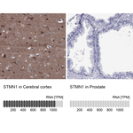 Stathmin 1 Polyclonal Antibody