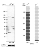 Stathmin 1 Antibody in Western Blot (WB)
