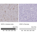 GFAP Antibody in Immunohistochemistry (Paraffin) (IHC (P))
