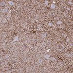 GFAP Antibody in Immunohistochemistry (Paraffin) (IHC (P))