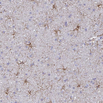 GFAP Antibody in Immunohistochemistry (Paraffin) (IHC (P))