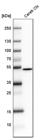 GFAP Antibody in Western Blot (WB)