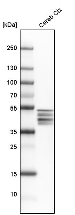 GFAP Antibody in Western Blot (WB)