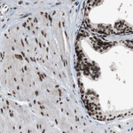Lamin A/C Polyclonal Antibody