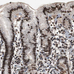Lamin A/C Antibody in Immunohistochemistry (Paraffin) (IHC (P))