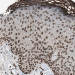 Lamin A/C Antibody in Immunohistochemistry (Paraffin) (IHC (P))