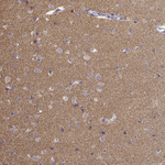 alpha Synuclein Antibody in Immunohistochemistry (Paraffin) (IHC (P))