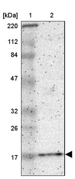 alpha Synuclein Antibody in Western Blot (WB)