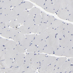 Caspase 3 Antibody in Immunohistochemistry (Paraffin) (IHC (P))