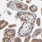 Caspase 3 Antibody in Immunohistochemistry (Paraffin) (IHC (P))