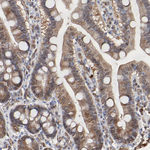 Caspase 3 Antibody in Immunohistochemistry (Paraffin) (IHC (P))