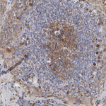 Caspase 3 Antibody in Immunohistochemistry (Paraffin) (IHC (P))
