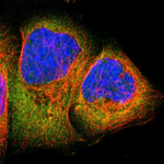 RSK1 Polyclonal Antibody