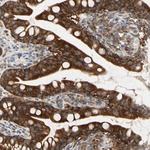 RSK1 Antibody in Immunohistochemistry (Paraffin) (IHC (P))