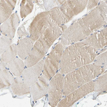 RSK1 Antibody in Immunohistochemistry (Paraffin) (IHC (P))