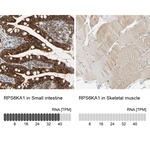RSK1 Antibody in Immunohistochemistry (Paraffin) (IHC (P))