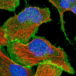 beta Catenin Polyclonal Antibody
