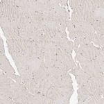 beta Catenin Antibody in Immunohistochemistry (Paraffin) (IHC (P))