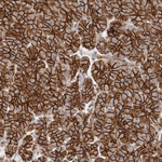 beta Catenin Antibody in Immunohistochemistry (Paraffin) (IHC (P))