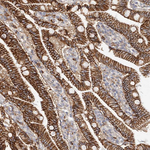 beta Catenin Antibody in Immunohistochemistry (Paraffin) (IHC (P))