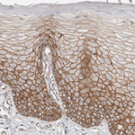 beta Catenin Antibody in Immunohistochemistry (Paraffin) (IHC (P))
