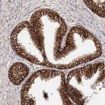 beta Catenin Antibody in Immunohistochemistry (Paraffin) (IHC (P))