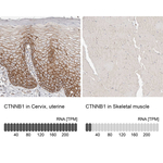 beta Catenin Antibody in Immunohistochemistry (Paraffin) (IHC (P))