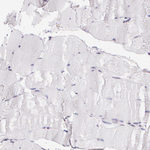 Amyloid Precursor Protein Antibody in Immunohistochemistry (Paraffin) (IHC (P))